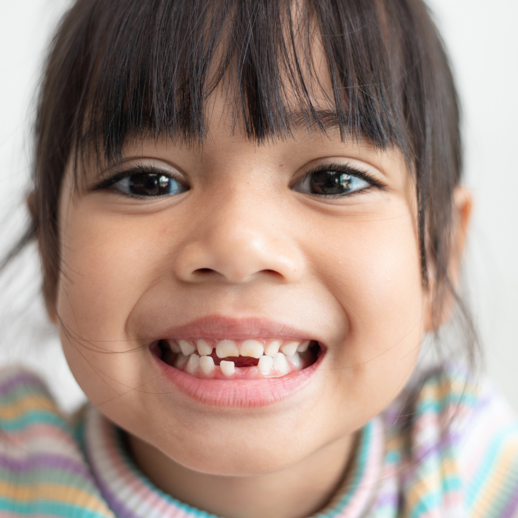 Children’s dentistry in Leicester at Smile Perfections dentist Leicester, featuring a young girl smiling cutely with a missing tooth, highlighting gentle dental care for kids.