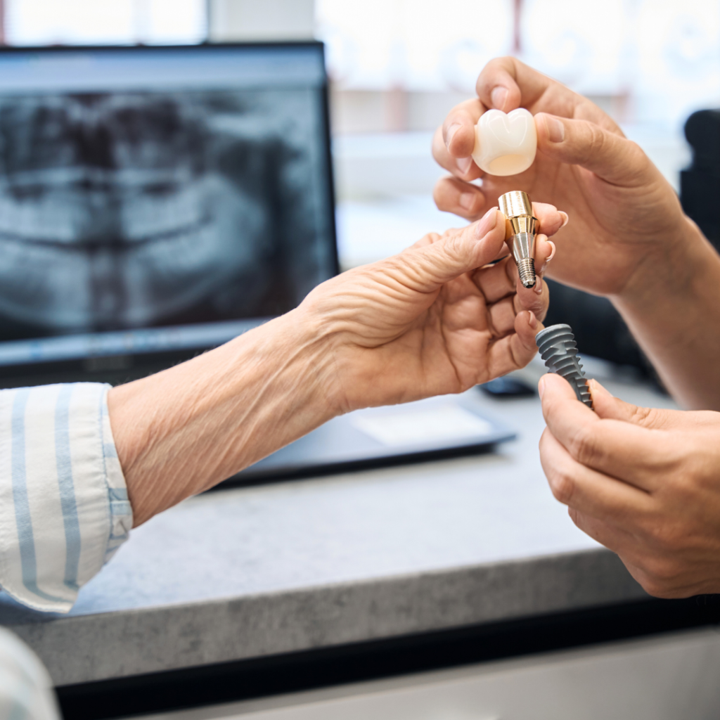 dentist showing a mock-up of a dental implant to patient to see exactly how it looks like