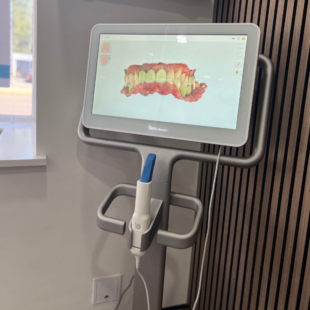 iTero scan at Smile Perfections in Leicester, capturing precise 3D digital impressions to support Invisalign treatment and comprehensive dental care planning.