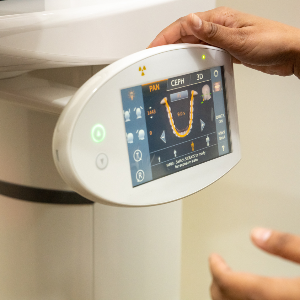 CBCT scan example at Smile Perfections dentist Leicester, showing detailed 3D imaging used for precise diagnosis and dental treatment planning.