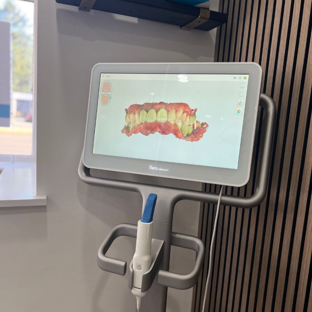 iTero scanner at Smile Perfections in Leicester, providing high-resolution digital impressions for accurate Invisalign treatment and restorative dental planning.