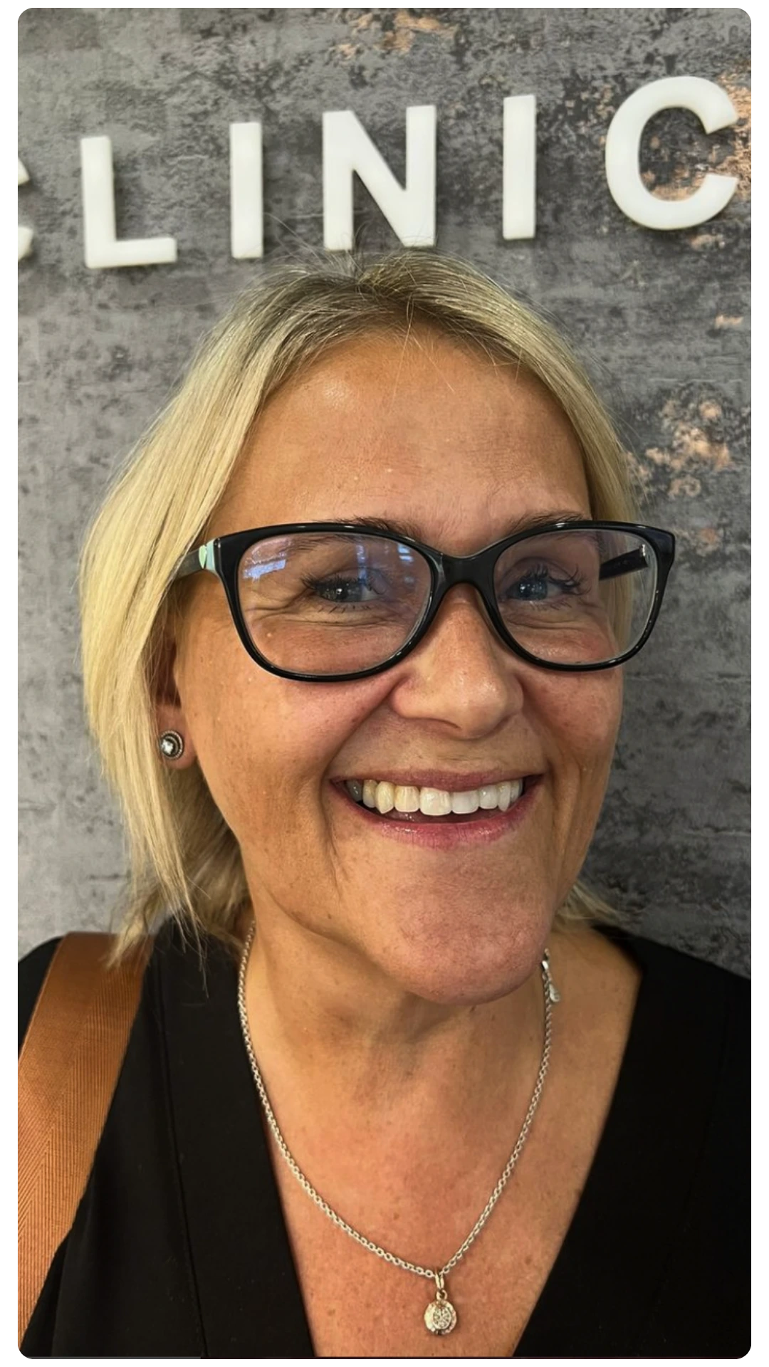 Patient smiling at the reception of Smile Perfections in Leicester, reflecting a welcoming and comfortable patient experience.