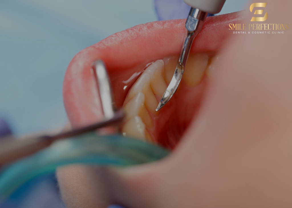 how to clean calculus from teeth_ - patient during hygiene consultation