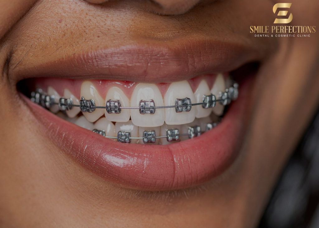blister in mouth from braces - what to do